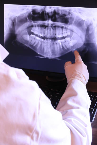 Best Emergency Dentist for Lost Fillings or Crowns in Woodland Beach, MI
